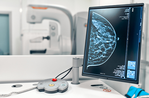 production-composants-imagerie-medical Production de composants d'imagerie medicale